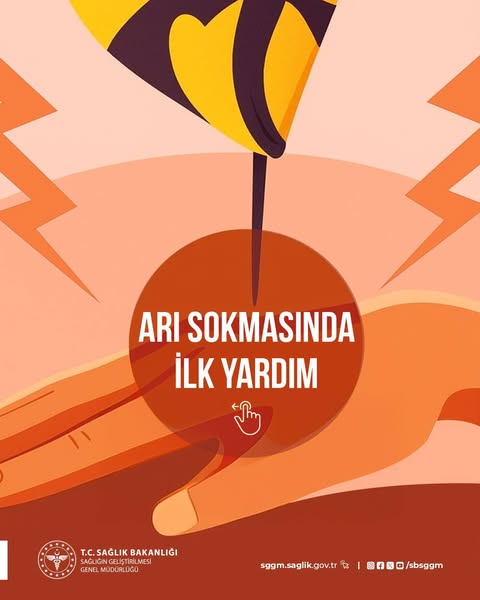 Arı sokmalarının potansiyel riskleri, sokulan bölgenin konumu ve kişinin alerjik