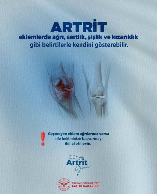 Artrit Hastalığına Dikkat Çekildi Afyonkarahisar Sağlık Müdürlüğü, Dünya Artrit Günü